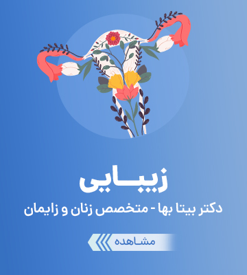زیبایی