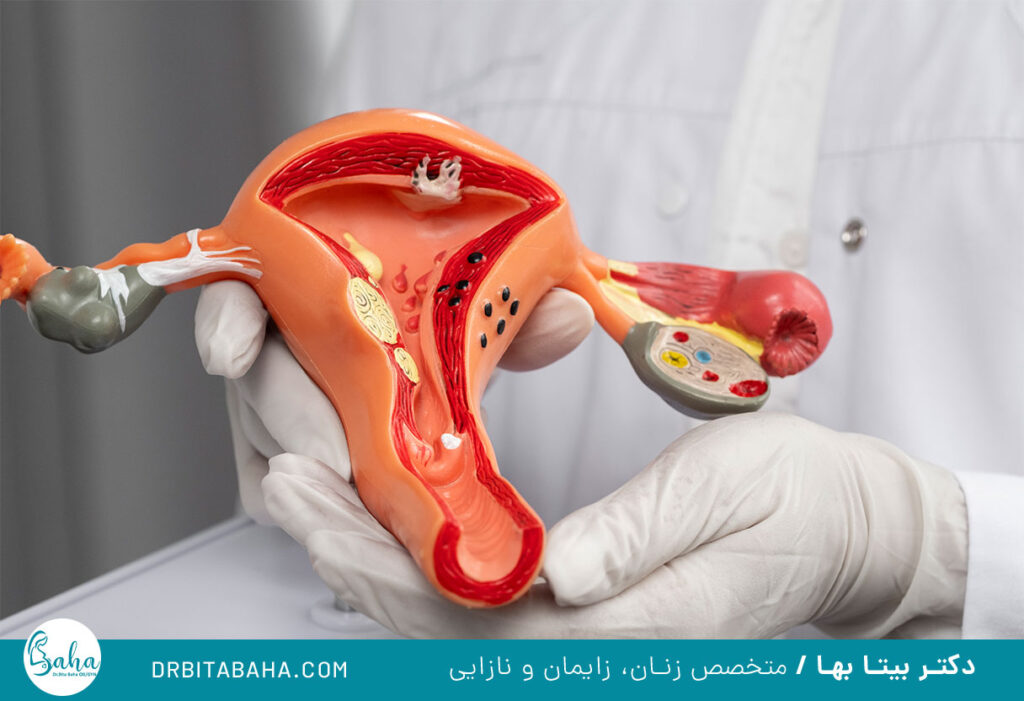 آشنایی با آناتومی واژن