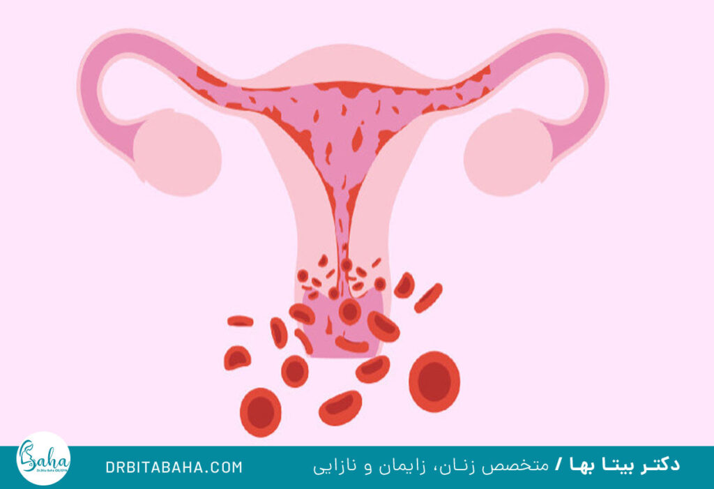 پیشگیری اختلالات قاعدگی
