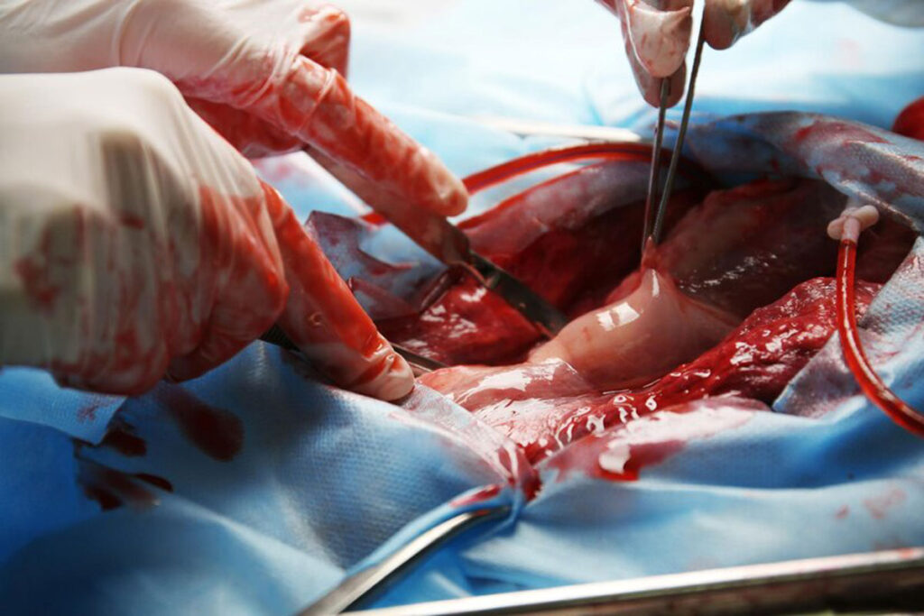 عمل پرینورافی