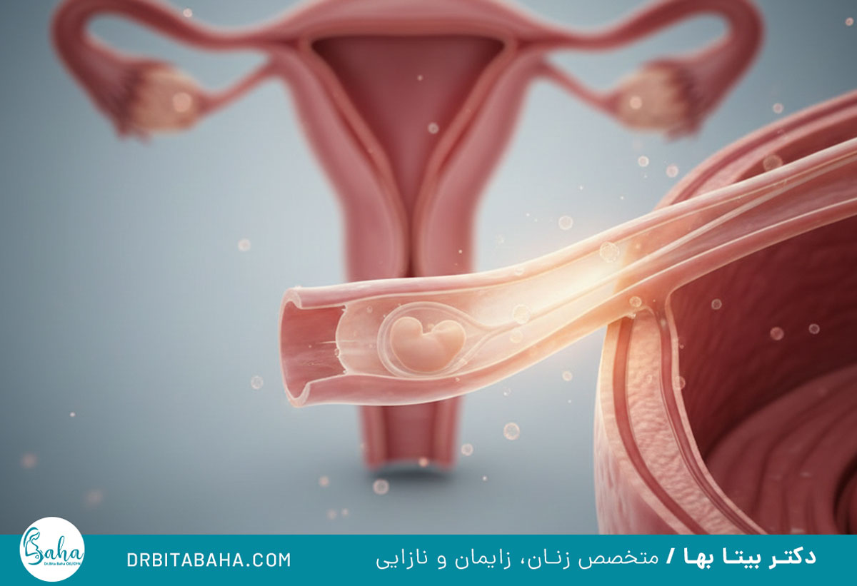 بارداری خارج رحمی و لوله فالوپ