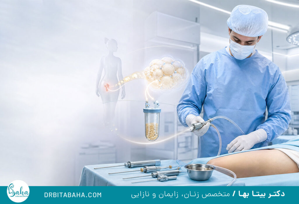 تزریق چربی به بیکینی